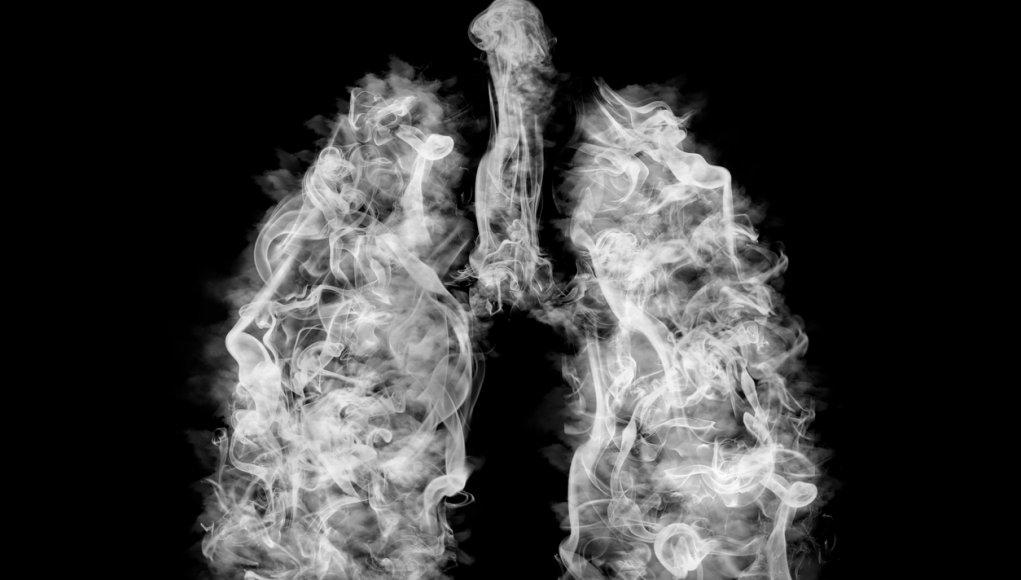 Illustration of a toxic smoke in lungs