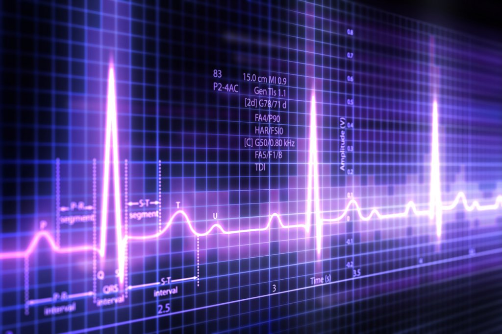 Purple zig-zaging lines on an EKG readout