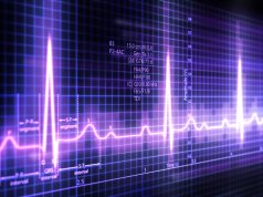 Purple zig-zaging lines on an EKG readout