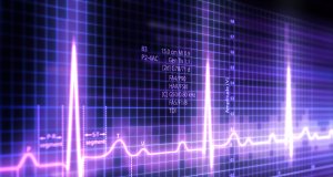 Purple zig-zaging lines on an EKG readout